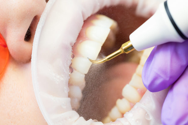 a person getting dental health services done