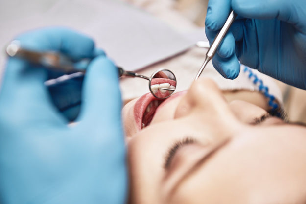 Dental Filling for Cavities someone gets a dental filling done for a cavity