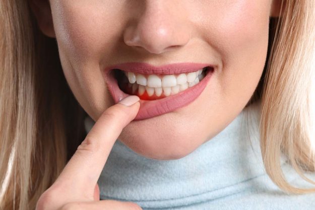 a woman concerned about gum disease