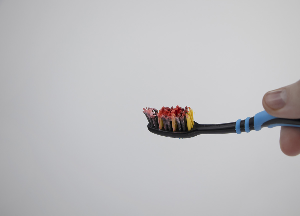 reasons for bleeding gums