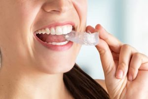 woman using a guard to prevent teeth grinding