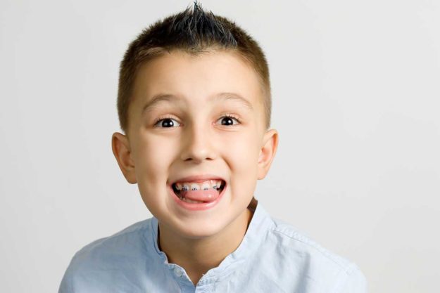 braces for kids