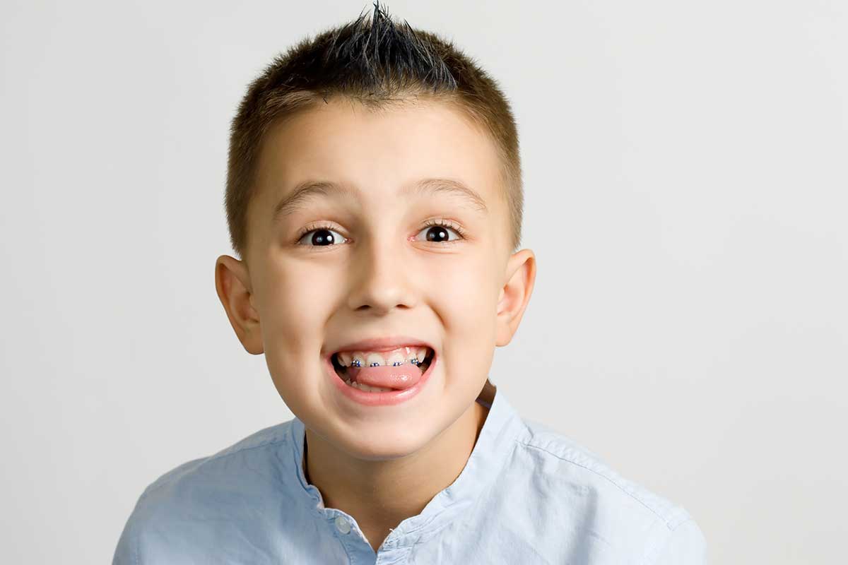 braces for kids