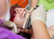 dental veneers